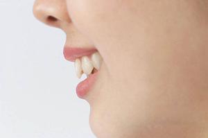 脂肪吸引を安全に行うための徹底ガイド：効果・リスク・選び方のポイント